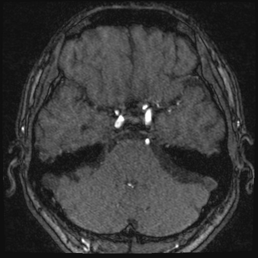 Click on the Serie image to view the images of VILLANUEVA, WILLIAM A.